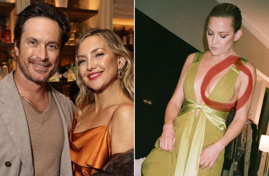 Oliver Hudson Playfully Teases Sister Kate Hudson About Her Bold Dress Choice
