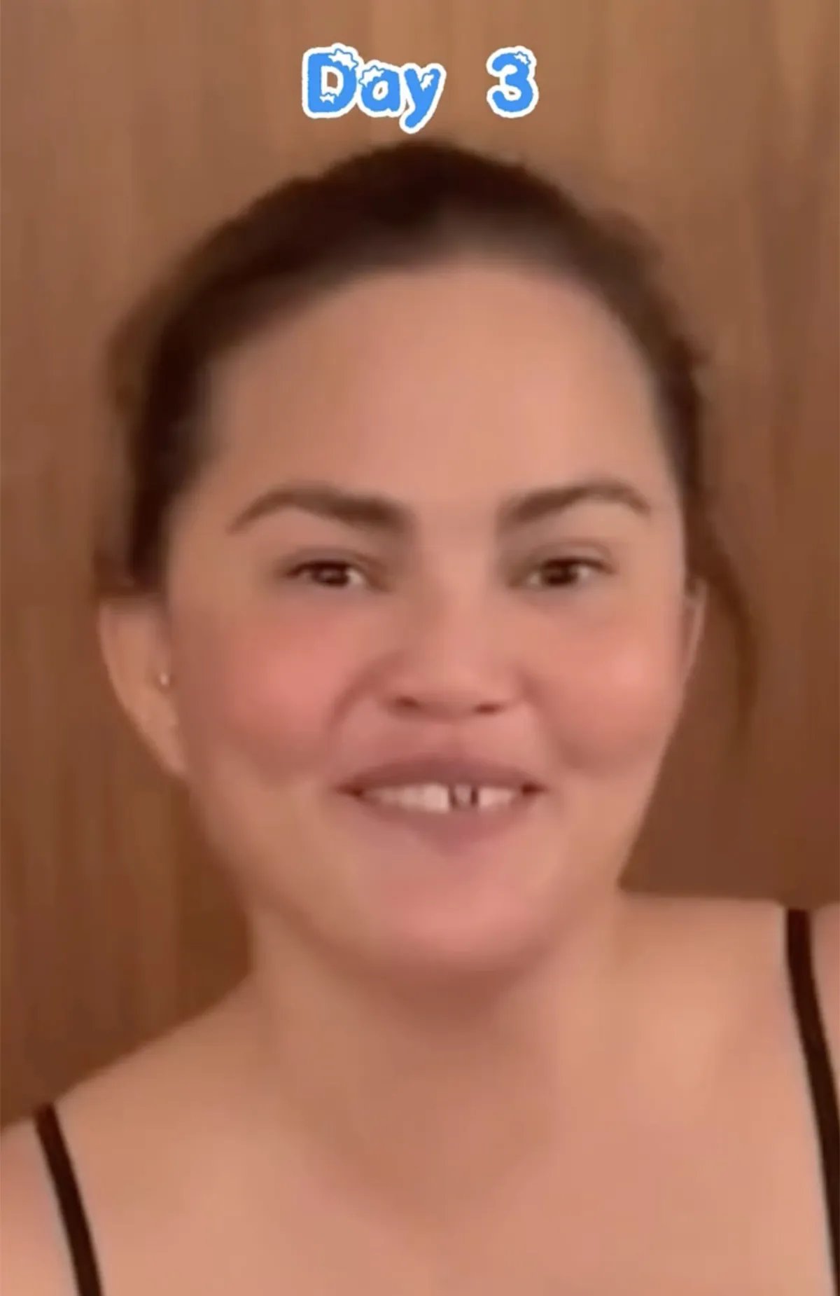 Chrissy Teigen old tooth