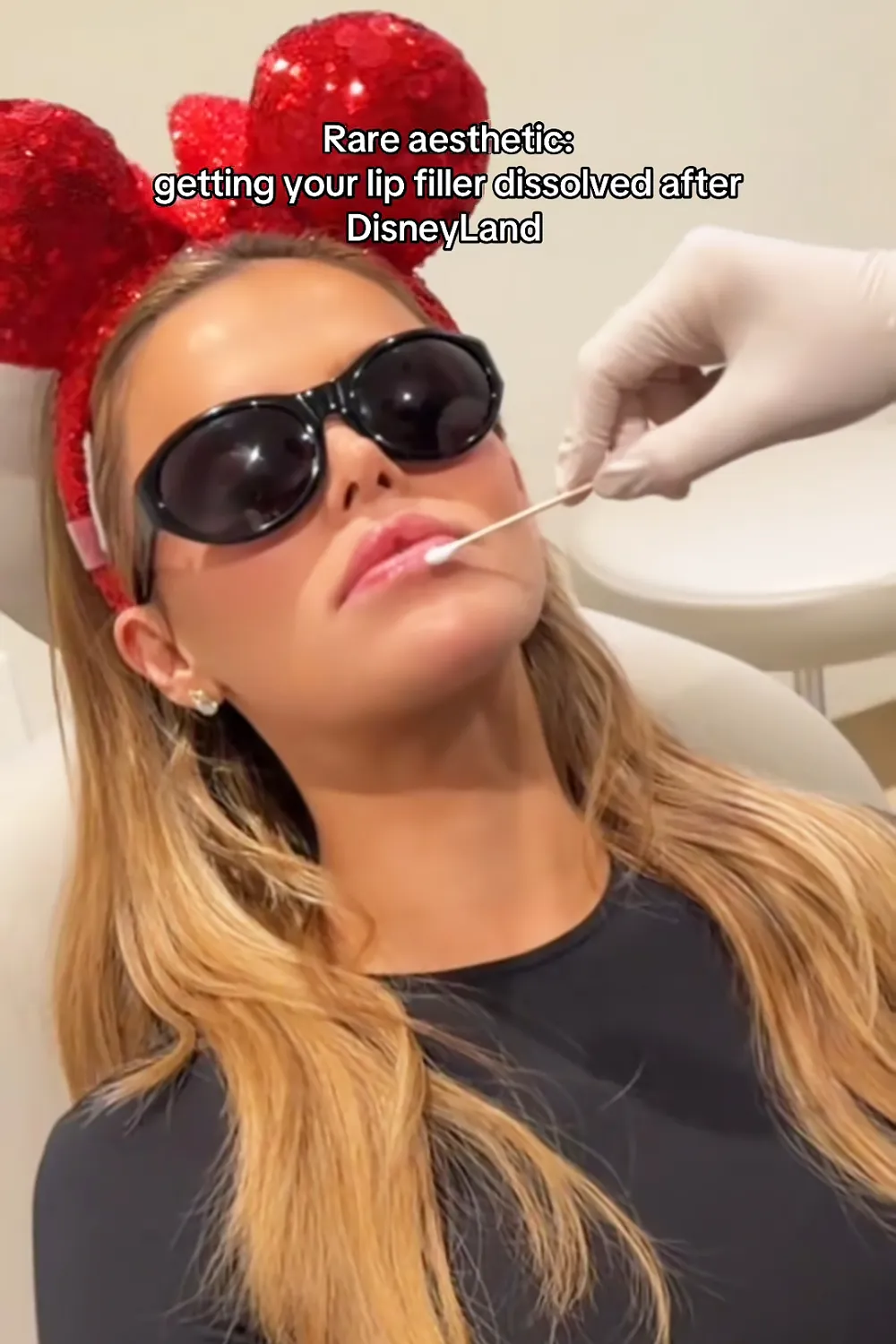 Brooks Nader Dissolves Lip Filler as a Gift to Her Parents.