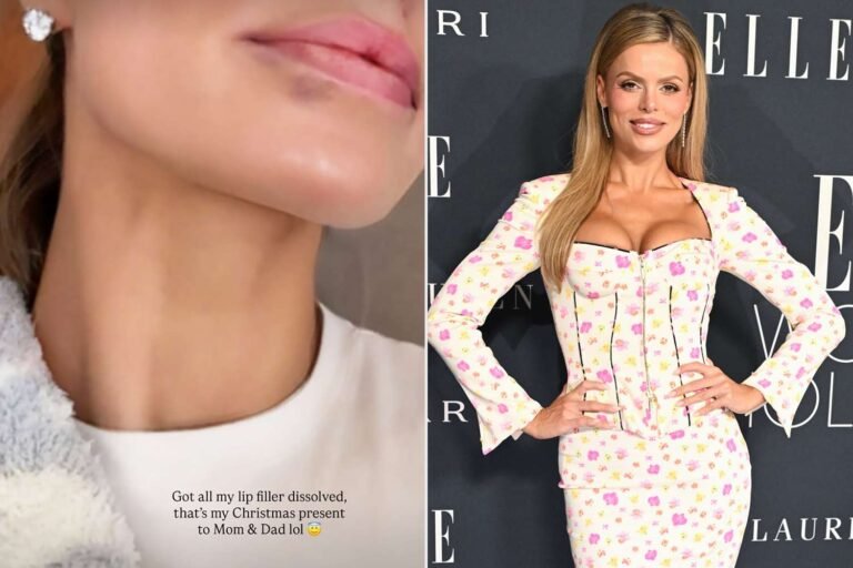 Brooks Nader Shares a Fun Reason Behind Dissolving Her Lip Filler: A Holiday Gift for Her Parents