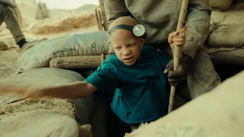 Filmmaker Simon Panay Discusses White Skin and the Importance of Albinism Awareness in Oscar-Listed Short Film