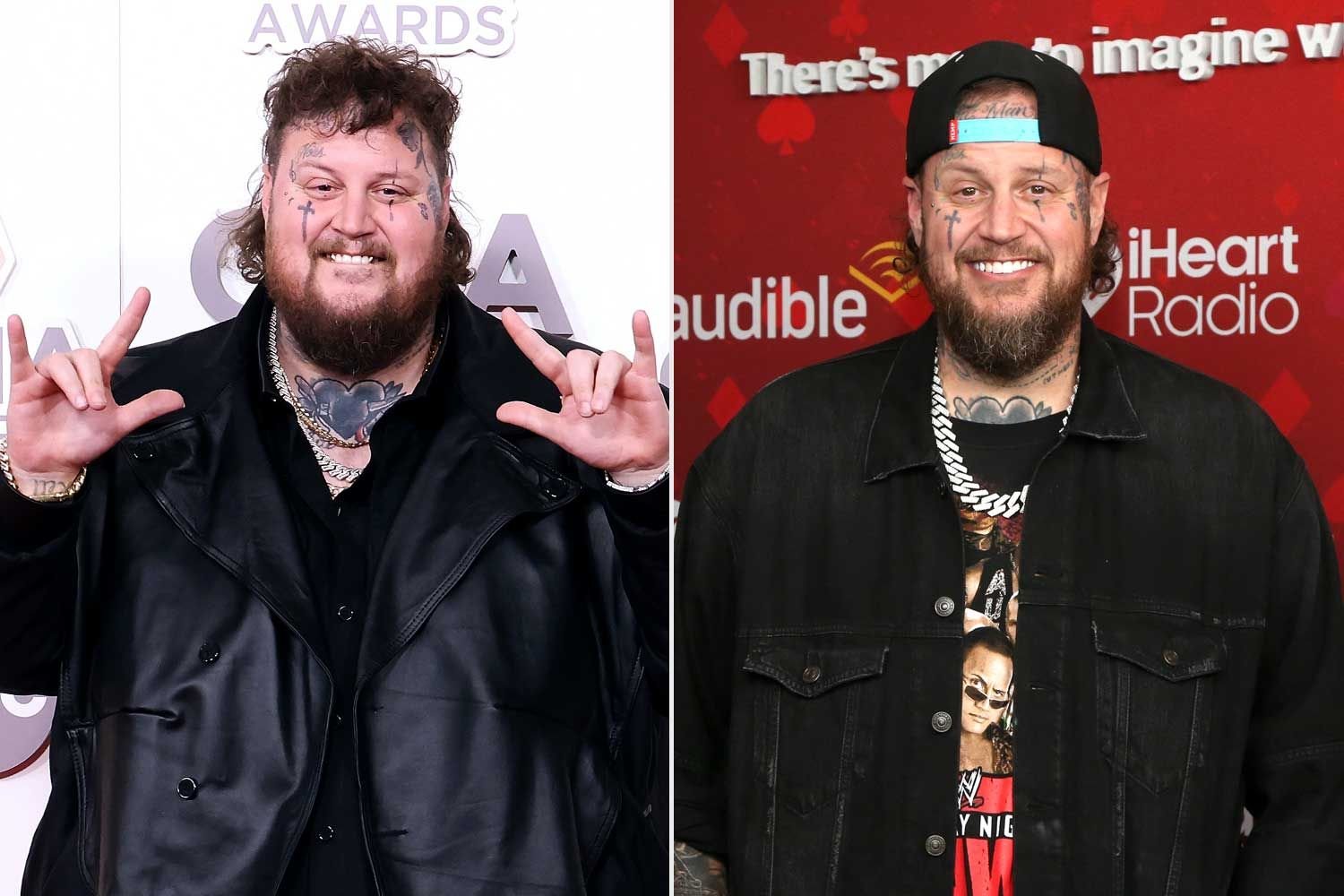 Jelly Roll’s Journey to Losing Nearly 300 Pounds: Insights and Reflections