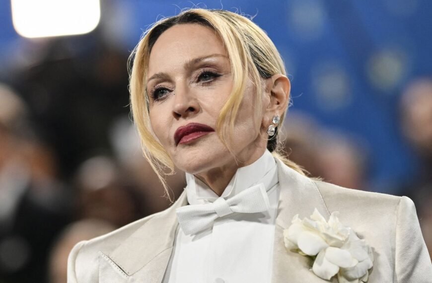 Madonna Stuns in a Chic Lace Minidress Paired with Fishnets