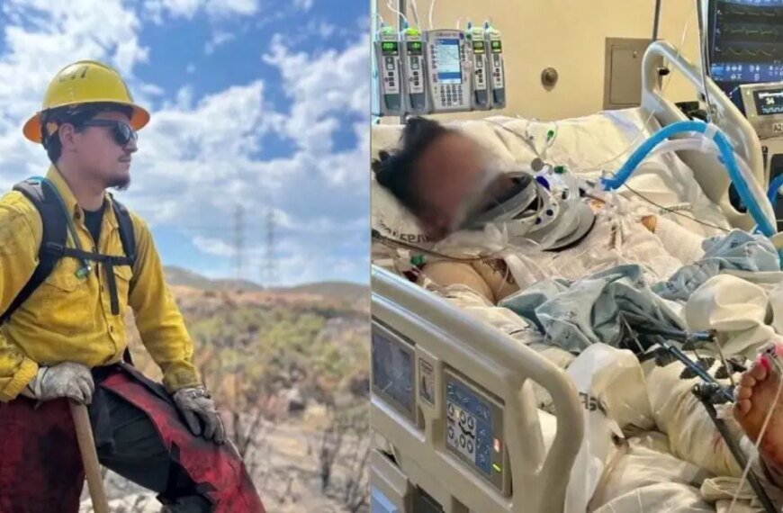 LA Firefighter Faces Life Changes After Car Accident Off 800-Foot Cliff