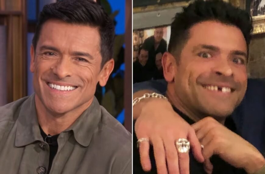 Mark Consuelos Shares Smile Before Getting His Tooth Fixed, While Kelly Ripa Reacts to His Bold Look