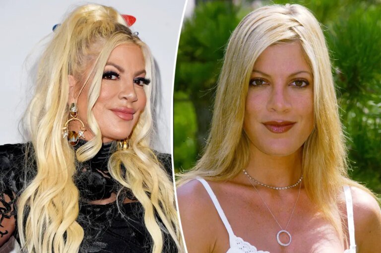 Tori Spelling addresses comments on her appearance and opens up about fillers