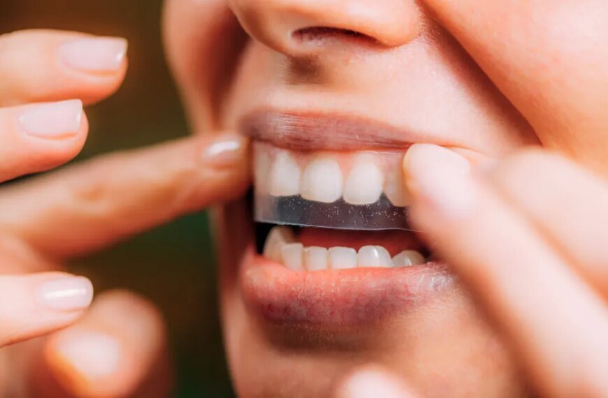 Amazon Shoppers Notice a Significant Improvement After Trying These Teeth Whitening Strips