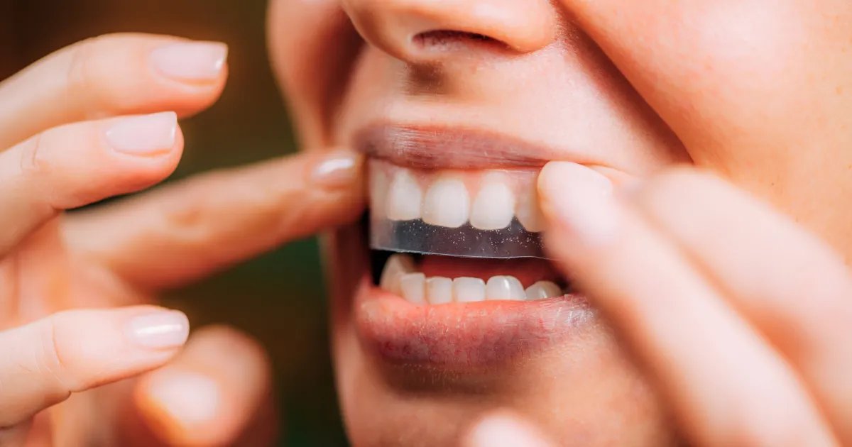 Amazon Shoppers Notice a Significant Improvement After Trying These Teeth Whitening Strips