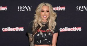 Bunnie Xo Shares Honest Update on Her Facelift Recovery Journey: A Personal Reflection