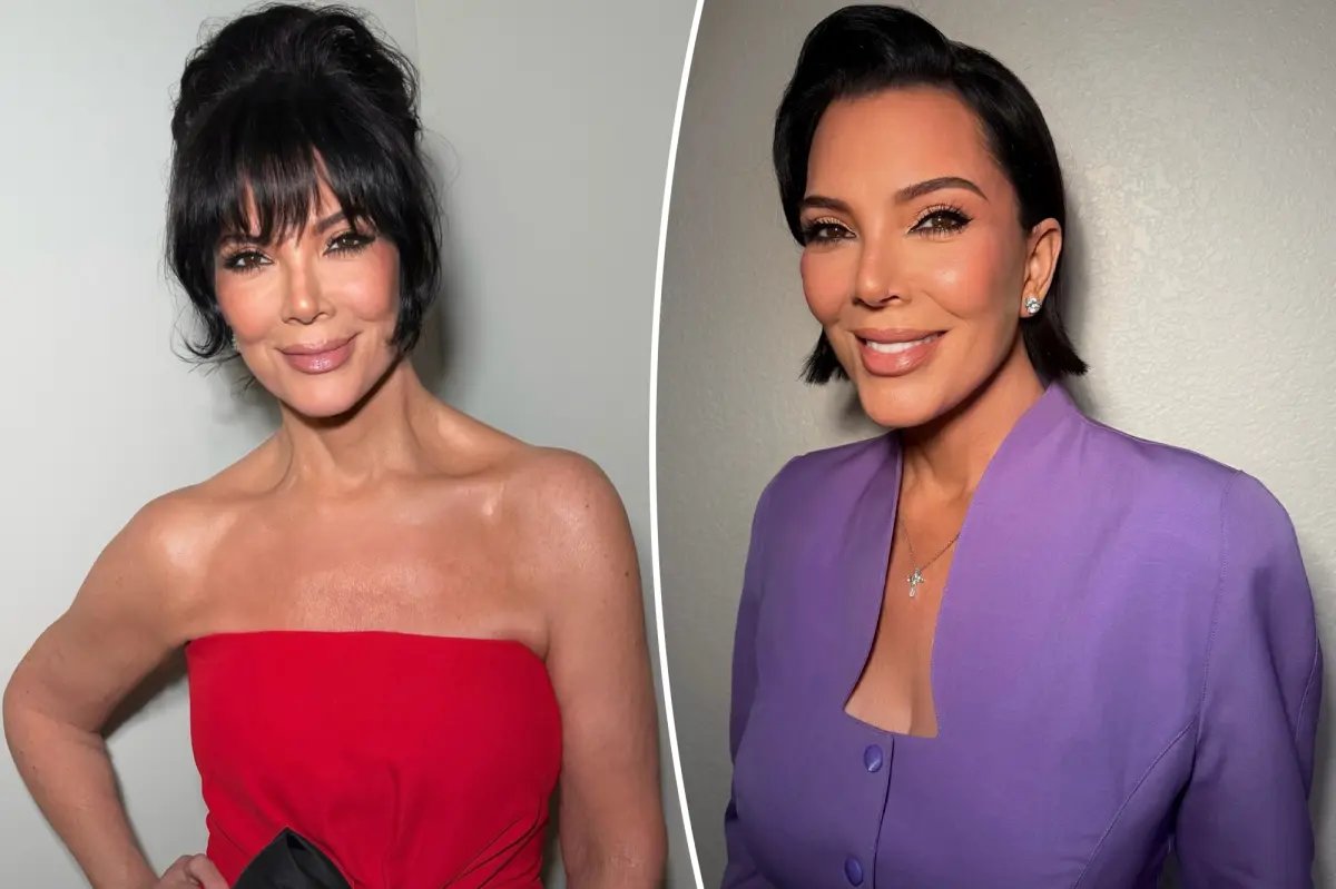 Kris Jenner Addresses Claims About Her $100K Facelift and Shares Her Feelings