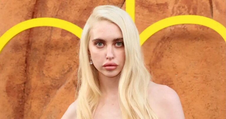Chloe Cherry Shares Her Journey with Lip Fillers, Botox, and More in Euphoria