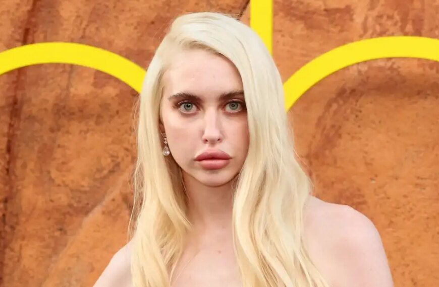 Chloe Cherry Shares Her Journey with Lip Fillers, Botox, and More in Euphoria